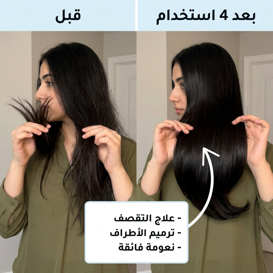 قبل وبعد — علاج التقصف وترميم الأطراف